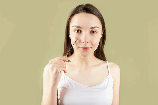 Does PCOS Cause Acne: How to Manage Skin Issues Associated with PCOS